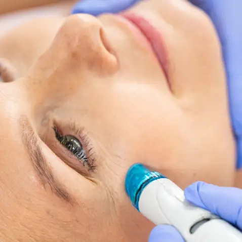 full-circle-aesthtics-woman-getting-a-hydra-facial-treatment